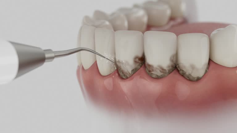 Trusted Dental Crowns And Bridges service in Mulberry, OH - Dentist Open Now
